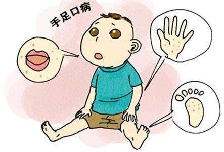 春意盎然，勿忘防治手足口